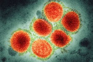 swine flu disease fatal