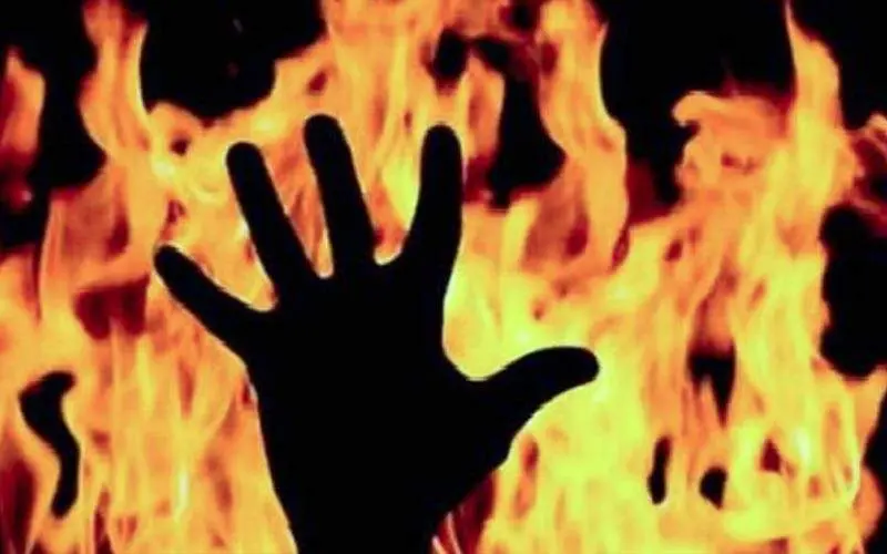 Woman battles for life after being engulfed in flames in Visakhapatnam
