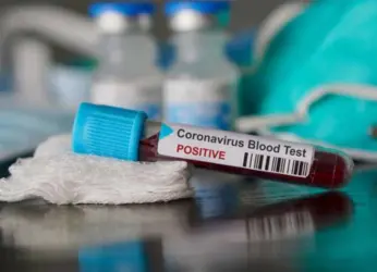 Second COVID-19 testing machine to be installed at the virology lab at KGH