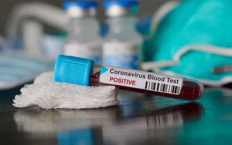 Andhra Pradesh sees 21 more coronavirus positive cases, total soars to 132