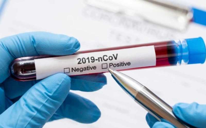 Women remained asymptomatic, now tested COVID-19 positive in Vizag