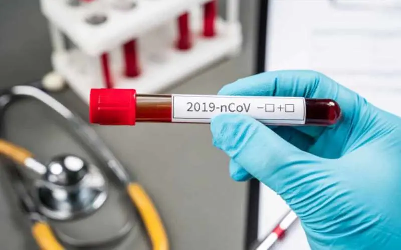 60-year-old woman in Vizag District tests COVID-19 positive, tally hits 23