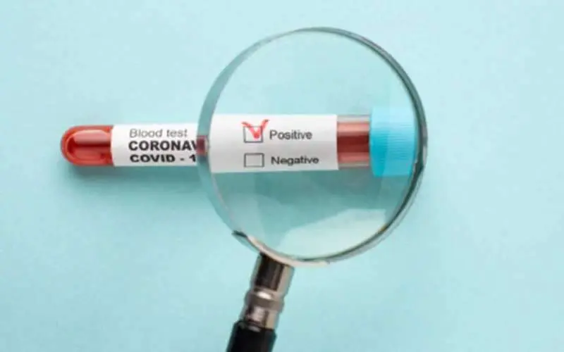 Total number of COVID-19 cases in AP rises to 2137, no new cases reported in Vizag