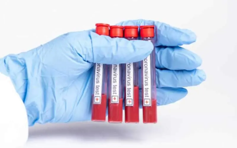 Andhra Pradesh sees COVID-19 cases rise to 2452, reports 66% recovery