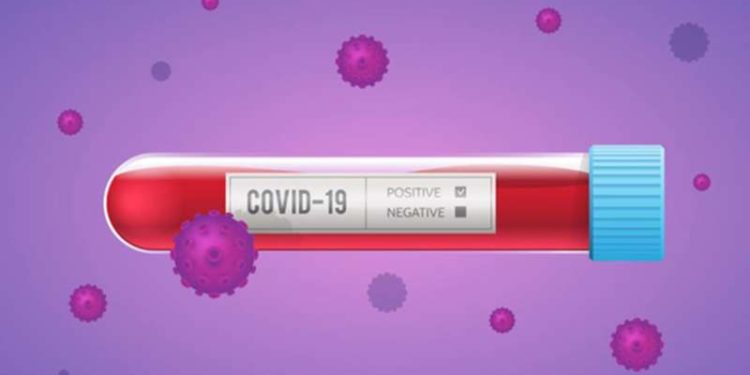33 more individuals in Andhra Pradesh test positive for COVID-19