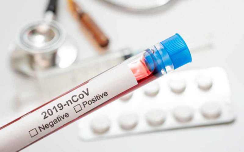 A family of 4 tests positive for COVID-19 in Vizag, district tally soars to 81