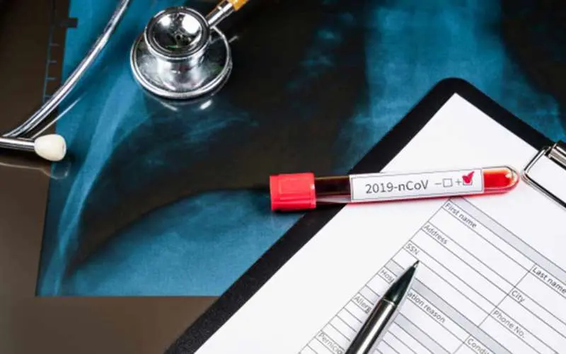 COVID-19 tally in Visakhapatnam district mounts to 29