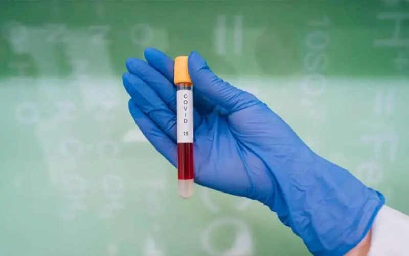 covid-19 cases in visakhapatnam