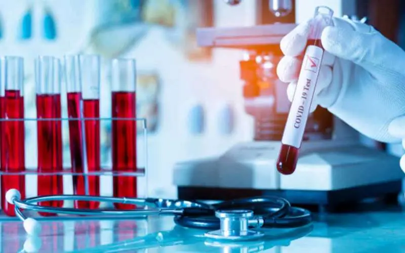 5 new COVID-19 cases take Visakhapatnam tally to 62; AP stands at 1930