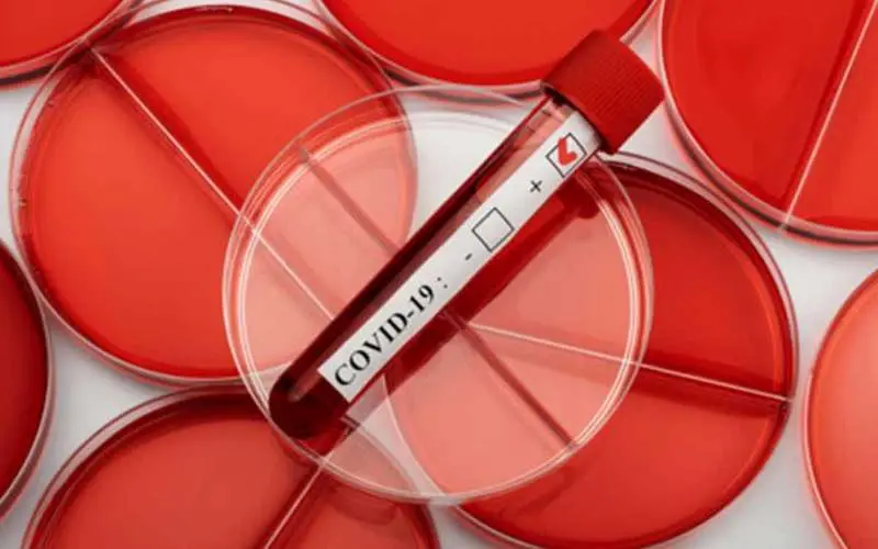 COVID-19 tally in Vizag goes up to 46; AP's count increases to 1833