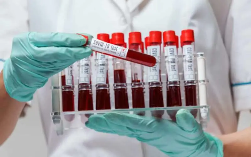 No social distancing at Dandu Bazaar in Vizag makes COVID-19 rampant