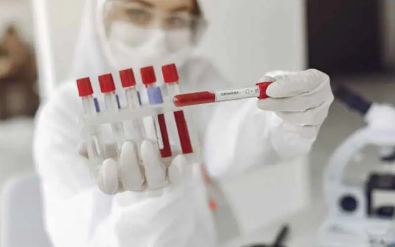 Visakhapatnam reports two new coronavirus cases, district count up to 84