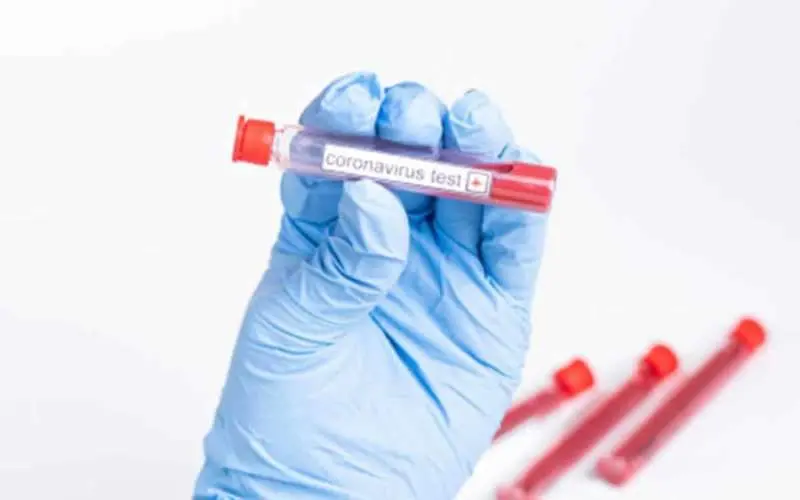 161 fresh COVID-19 cases reported in AP, overall state tally reaches 4460