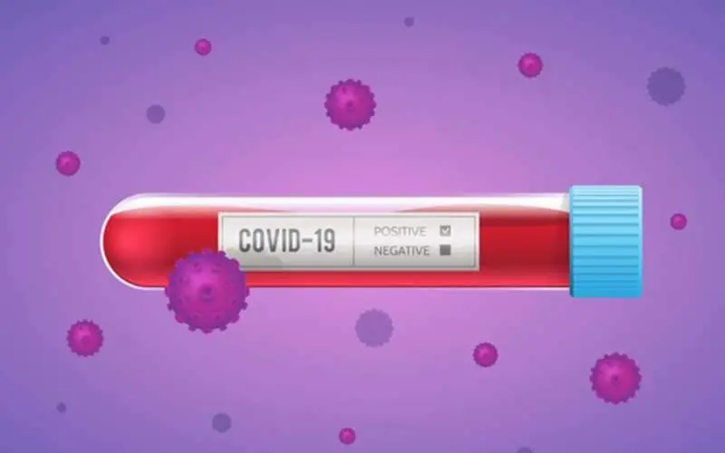 Overall COVID-19 count in Andhra Pradesh hits 4659 as 199 more test positive