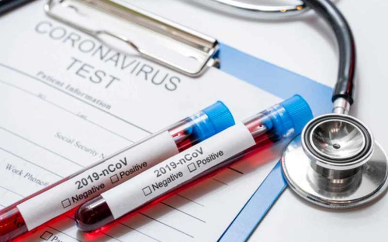 COVID-19 total in Andhra Pradesh reaches 3118 as 76 more test positive