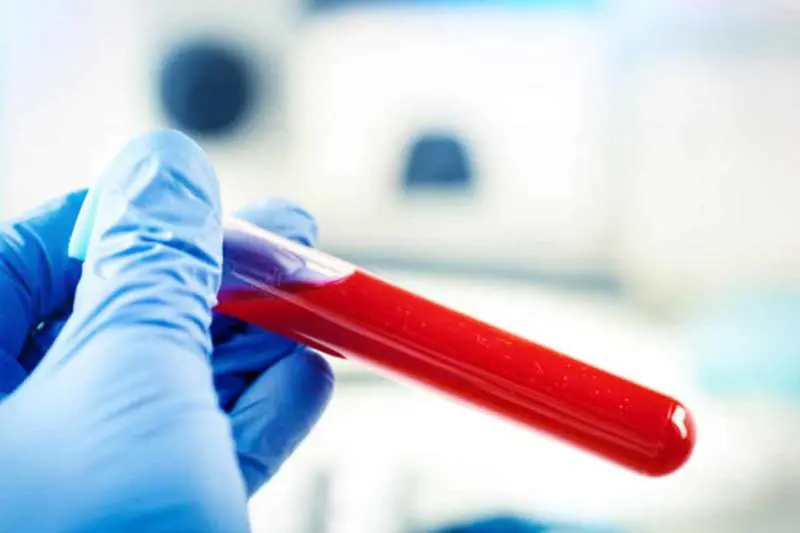 Vizag sees highest single-day spike with 29 new coronavirus cases