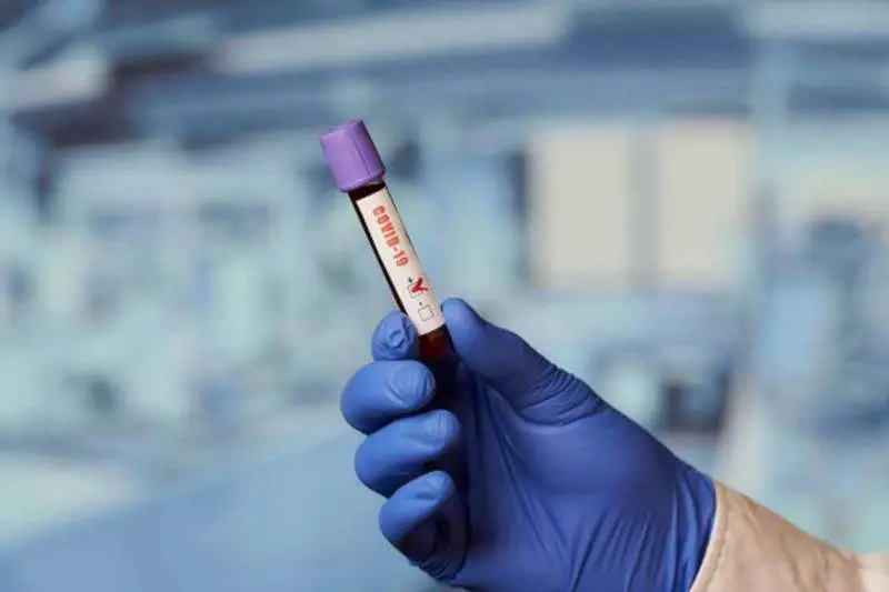 Vizag records 41 new COVID-19 cases as tally inches close to 500