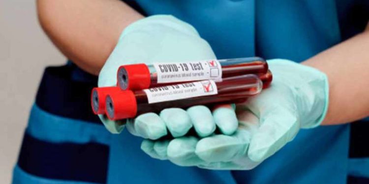 25 new COVID-19 cases detected in Vizag, containment clusters up to 99