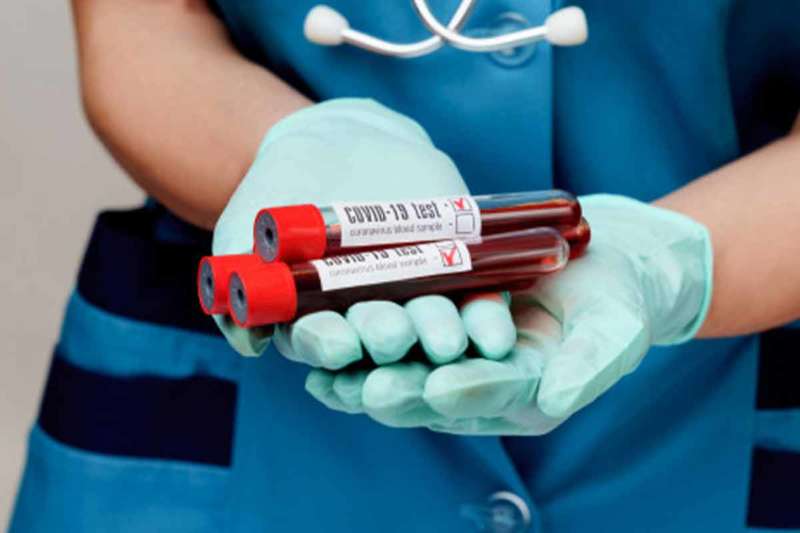 25 new COVID-19 cases detected in Vizag, containment clusters up to 99