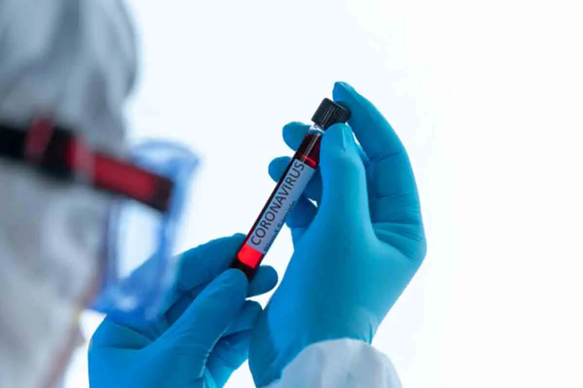 COVID-19 tally in Vizag crosses 800 with 58 new cases in a day