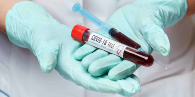 2 employees at Andhra Pradesh Secretariat test positive for coronavirus