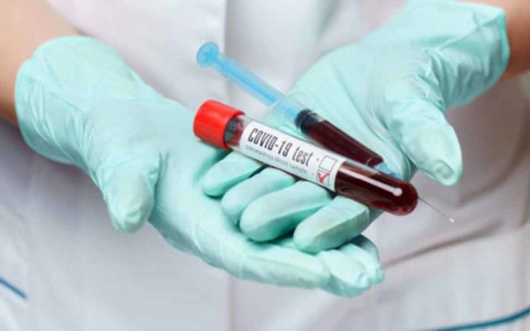 2 employees at Andhra Pradesh Secretariat test positive for coronavirus