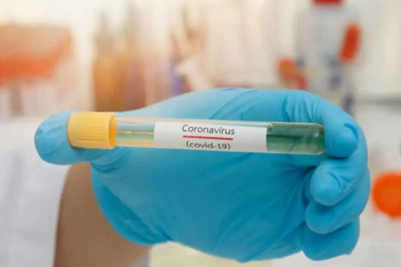 Vizag reports 14 new coronavirus cases, very active clusters increase to 43