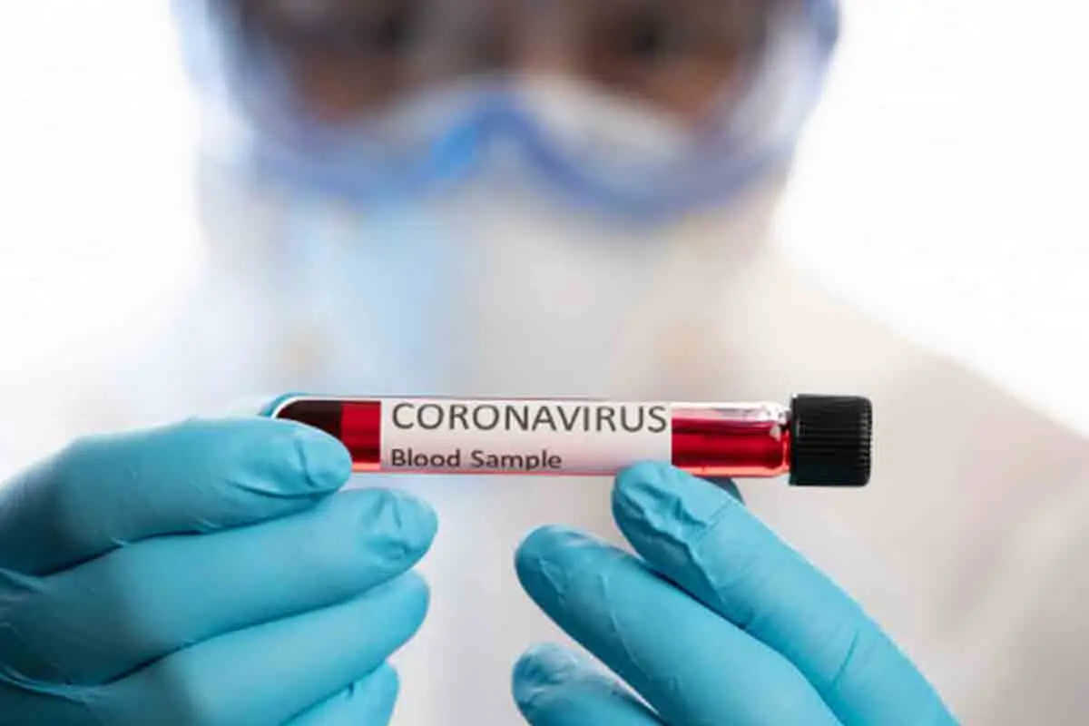 40 new COVID-19 cases reported in Vizag, AP tally stands at 18697