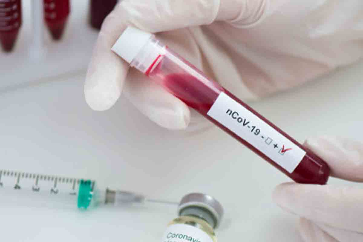 Vizag COVID-19 Update: District sees 179 new cases, 6 more deaths