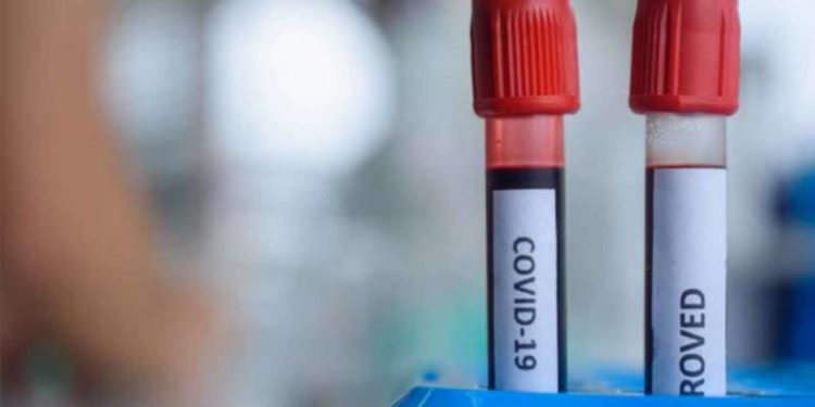 Vizag coronavirus Update: Tally inches towards the 1000-mark