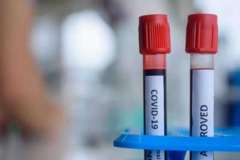 Vizag coronavirus Update: Tally inches towards the 1000-mark