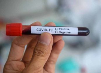 Minister calls for increased COVID-19 tests in Visakhapatnam