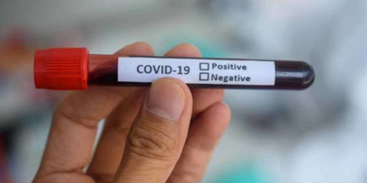 Minister calls for increasing COVID-19 tests in Visakhapatnam