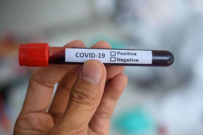 With 657 new cases, coronavirus tally in Andhra Pradesh crosses 15,000