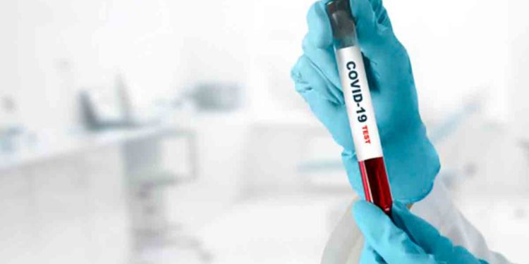 898 more test positive for coronavirus in Visakhapatnam, district tally crosses 6000