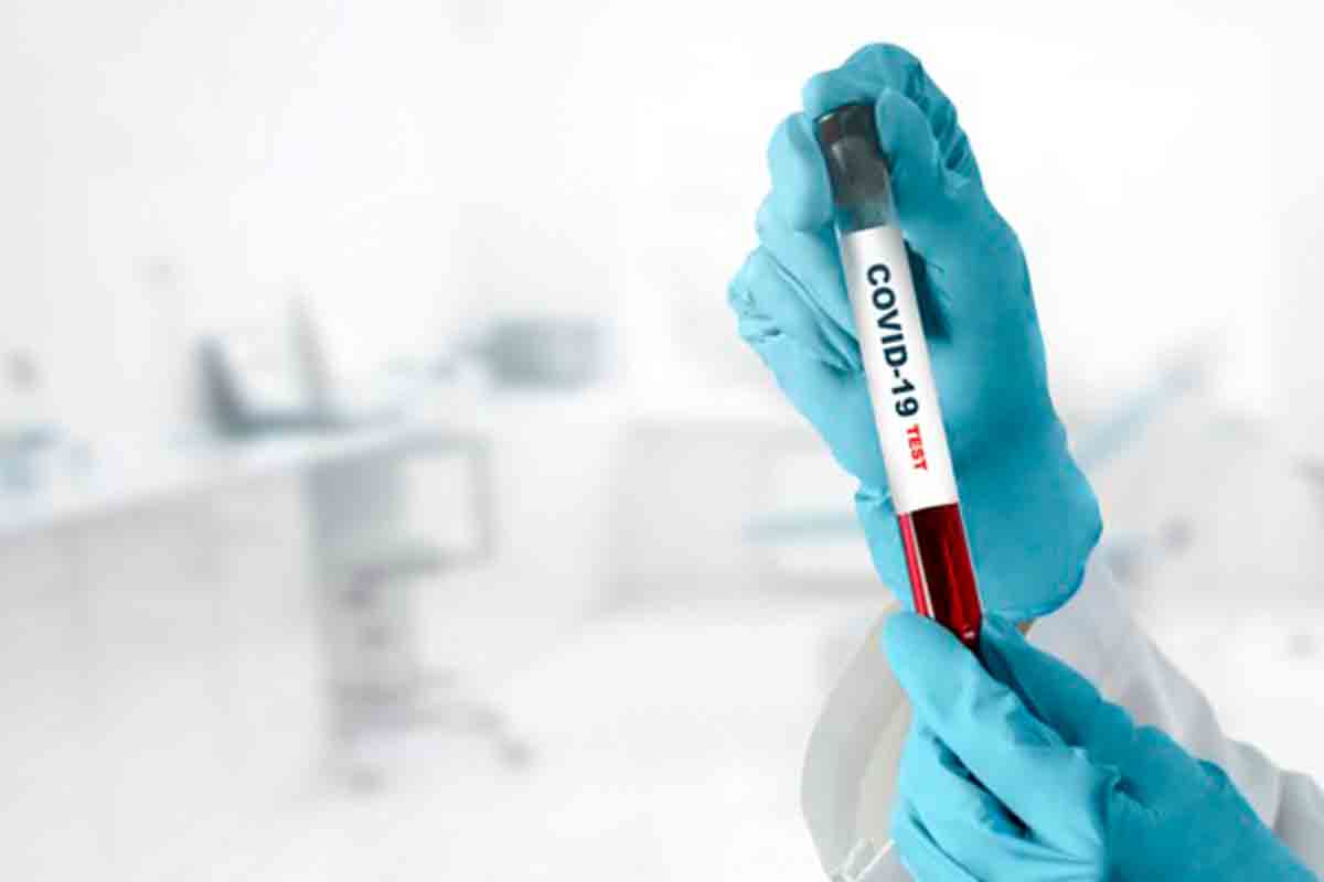 898 more test positive for coronavirus in Visakhapatnam, district tally crosses 6000