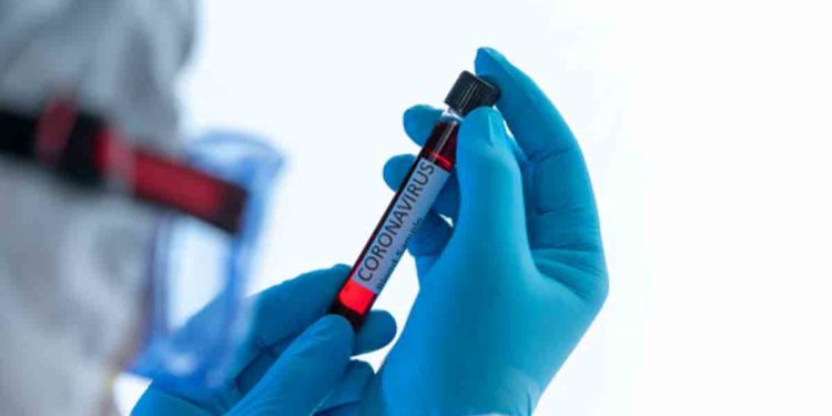 Total number of coronavirus cases in Visakhapatnam exceeds 15,000