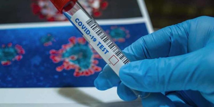 Visakhapatnam reports 449 new coronavirus cases, AP total crosses 6 lakh