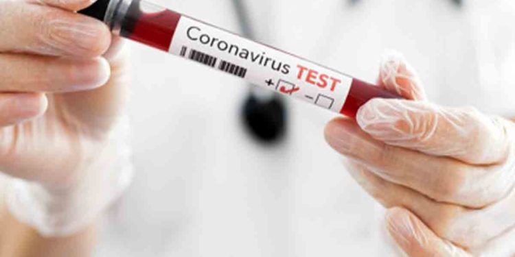Vizag sees sharp decline in COVID-19 cases reported in single day