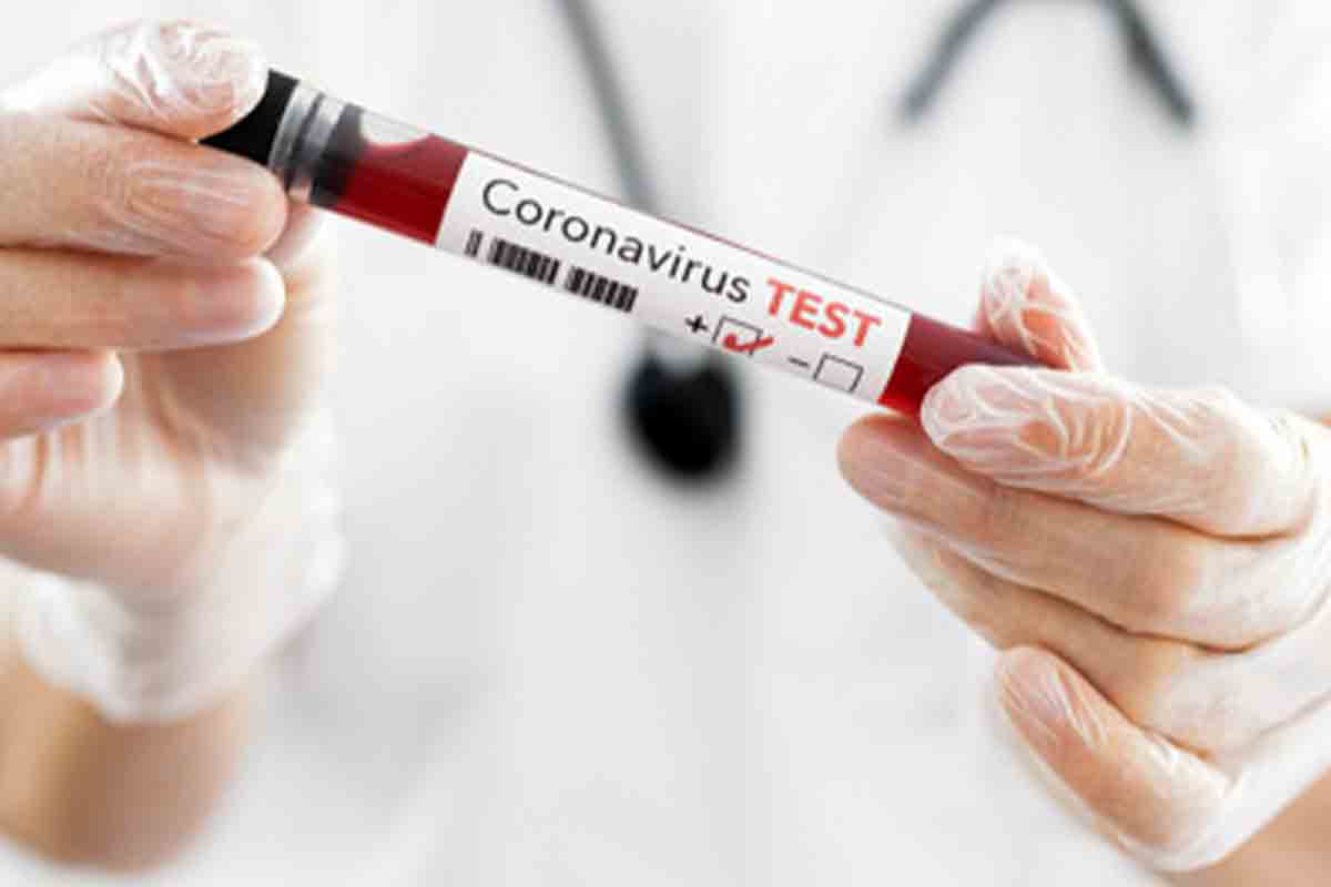 Vizag sees sharp decline in COVID-19 cases reported in single day