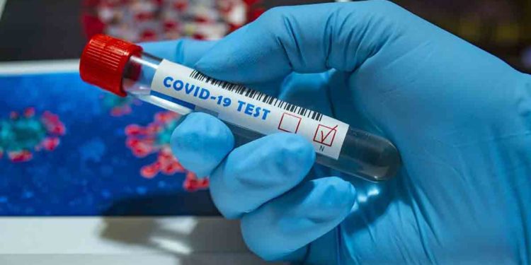 COVID-19 Updates: 120 test positive in Vizag, AP reports fewer than 3000 cases