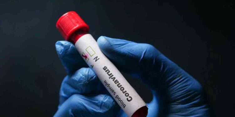 Vizag Coronavirus update: Recoveries surpassed 53,000-mark