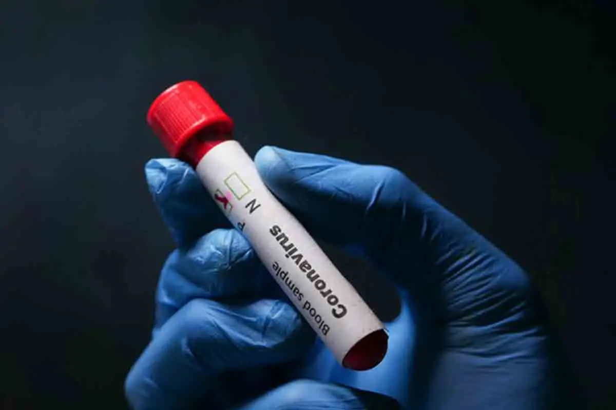 Vizag Coronavirus update: Recoveries surpassed 53,000-mark