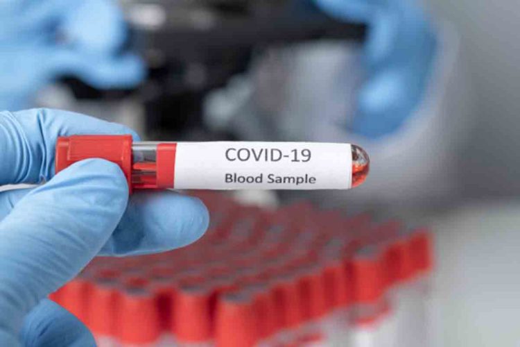 COVID-19 Update: Vizag reports 97 new infections