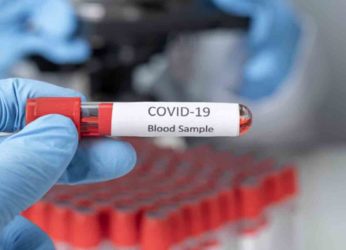 COVID-19 Update: Visakhapatnam sees 88 new cases, tally nears 59,000