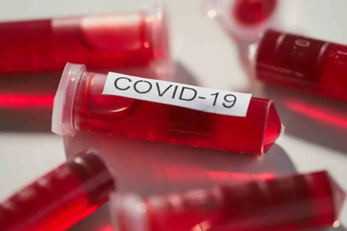 Visakhapatnam reports 135 new coronavirus cases, toll reaches 484