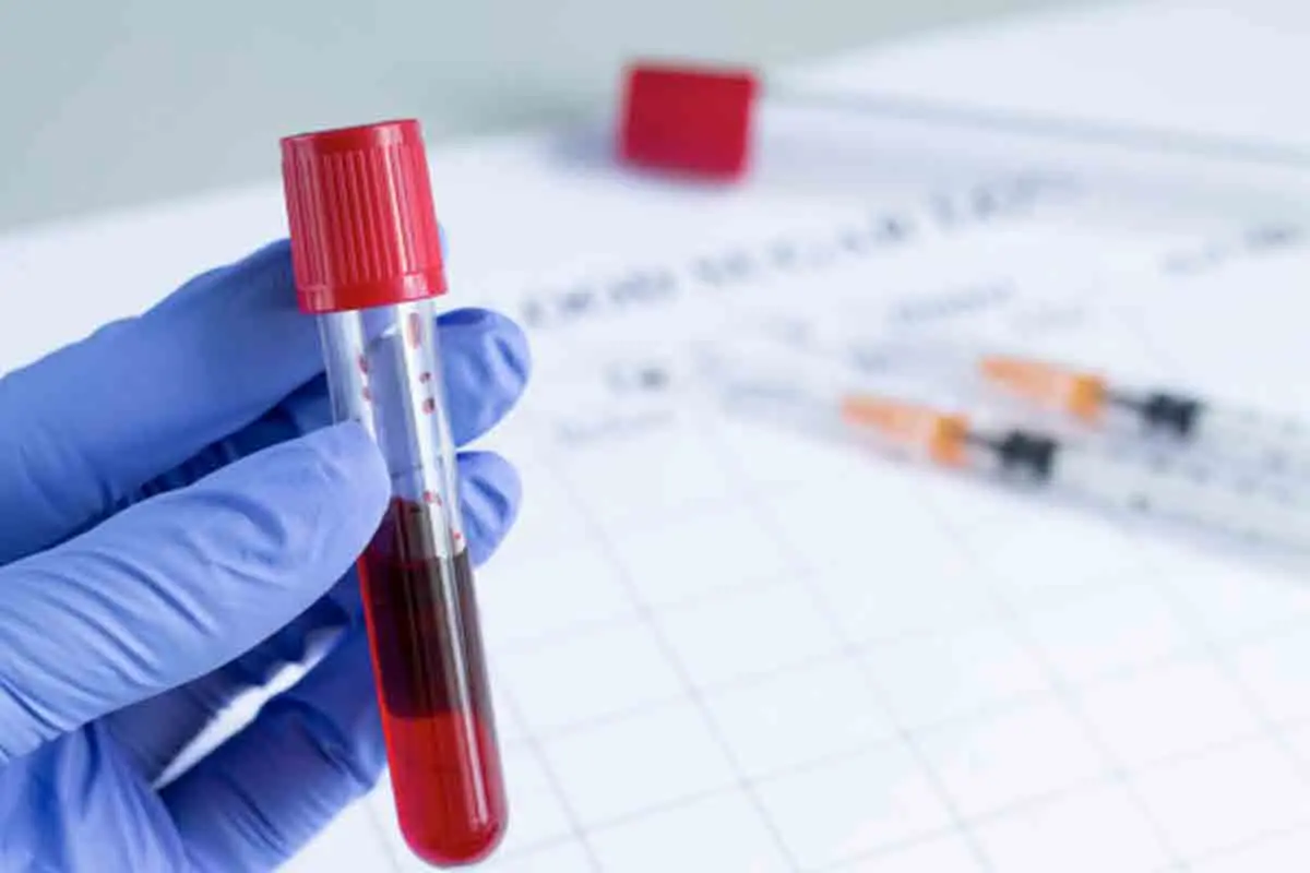 Vizag district authorities trace contacts of Covid positive woman from UK