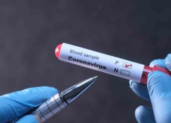 Seven-year-old UK returnee tests positive for COVID-19 in Vizag