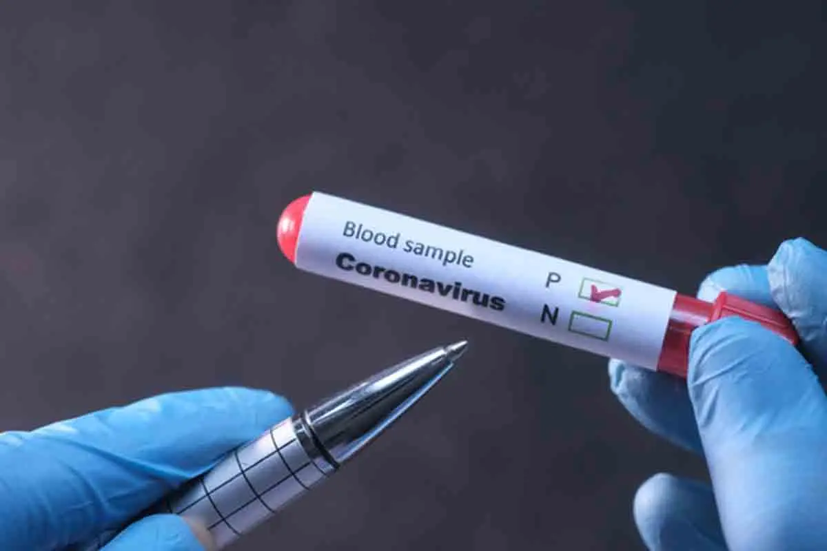 Seven-year-old UK returnee tests positive for COVID-19 in Vizag