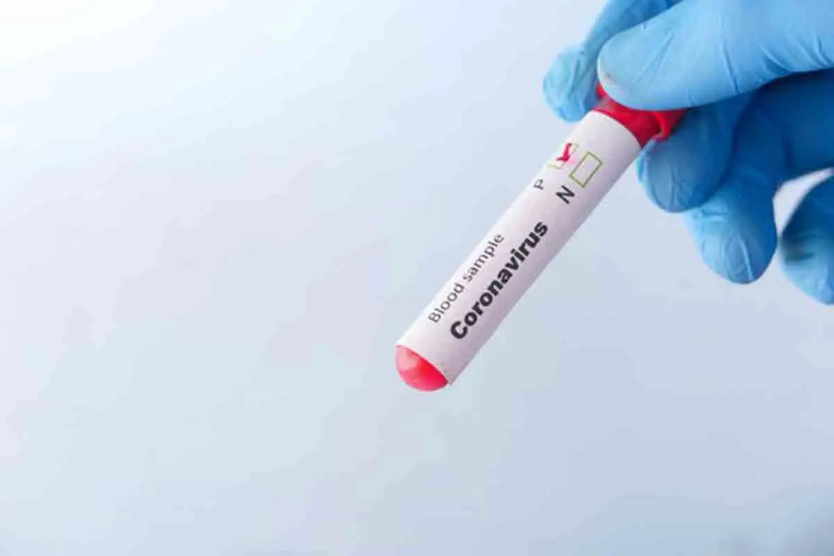 34 new Covid cases reported in Visakhapatnam, toll reaches 515